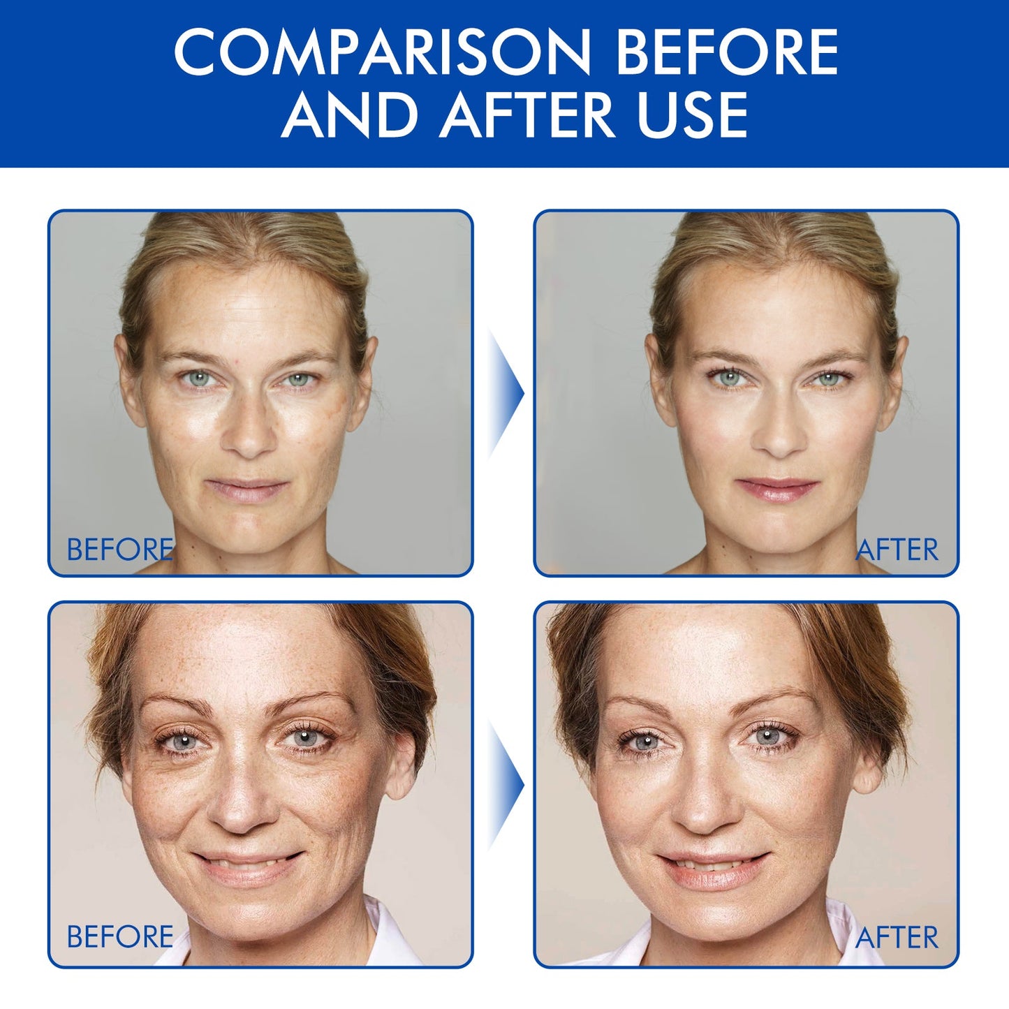 š„š„š„ Last Day 79% OFF Firming Anti-Aging Facial Serum