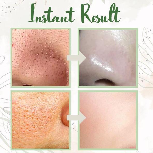 🔥Final Sale - Green Tea Deep Cleanse Mask - (Limited time discount 🔥 last day)
