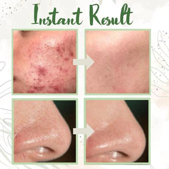 🔥Final Sale - Green Tea Deep Cleanse Mask - (Limited time discount 🔥 last day)