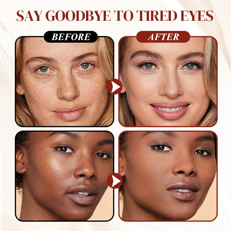 Undereye Corrector Concealer-🎁FREE GIFT