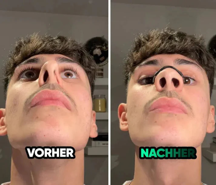 LOVILDS™ Magnetic Nose Patch