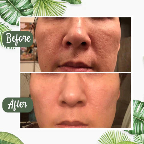 🔥Final Sale - Green Tea Deep Cleanse Mask - (Limited time discount 🔥 last day)