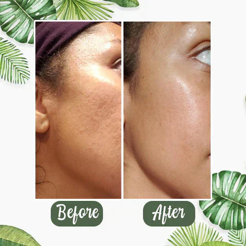 🔥Final Sale - Green Tea Deep Cleanse Mask - (Limited time discount 🔥 last day)