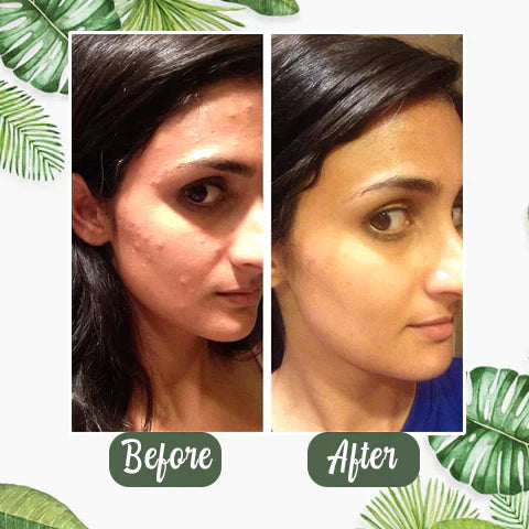 🔥Final Sale - Green Tea Deep Cleanse Mask - (Limited time discount 🔥 last day)