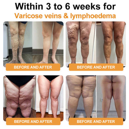 🎉🎉𝗟𝗶𝗺𝗶𝘁𝗲𝗱-𝗧𝗶𝗺𝗲 𝗦𝗽𝗲𝗰𝗶𝗮𝗹🔥𝐋𝐚𝐬𝐭 𝐝𝐚𝐲 𝐟𝐨𝐫 𝟖7% 𝐎𝐅𝐅🗽⚕️𝗨𝗹𝘁𝗿𝗮𝘀𝗼𝗻𝗶𝗰 𝗙𝗮𝘁 𝗕𝗹𝗮𝘀𝘁𝗶𝗻𝗴 ＆ 𝗙𝗮𝗿 𝗜𝗻𝗳𝗿𝗮𝗿𝗲𝗱 𝗕𝗹𝗼𝗼𝗱 𝗦𝘂𝗴𝗮𝗿 𝗕𝗮𝗹𝗮𝗻𝗰𝗶𝗻𝗴 𝗗𝗲𝘁𝗼𝘅 𝗪𝗿𝗶𝘀𝘁𝗯𝗮𝗻𝗱 - 𝗘𝗻𝗲𝗿𝗴𝘆 𝗕𝗮𝗹𝗮𝗻𝗰𝗲